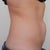 'Sucking it it' side view