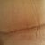 Post Op 7 weeks
close up of scar (CG marks! lol)