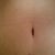 Post Op 7 weeks
BB stitches were done from the inside so no scars!