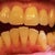 5-23-2012 Tray 6/24