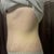 Soooooooo swollen. Left side. 4weeks post op.