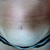 Before front view...