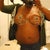Day 3 Post Op.  Front View.  Minimal draining on the right side (left in the pic)