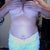 This is a pic of my scars you cant see them! They are small less then an inch and clear already! super great job!!
7 months after surge-- 640cc & 660 cc High profile implants Sub glandular (about muscle) Scar is under my breast.