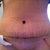 Day 4 Post Before Shower SWOLLEN!!!