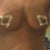 1.5 Weeks Post op