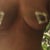 2 weeks Breast Lift