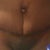 6 weeks Tummy Tuck Scar (no tape)