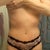 4 weeks post op