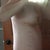 5 days po...slightly swollen