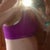5 days po....side view....looks like i should have had them put the fat in my arse....i have none :-)