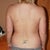 This is a before picture that I forgot to post. You can see the difference in my flank area with my after picture!