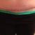 5 Weeks PO scar.  Still red, but healing very nicely.