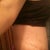 Almost 2 weeks post op