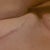 Using Scar Recovery Gel.  I only did the clevage area because I wanted to see if it really helped.