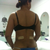 4 weeks post op