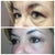 Day 36 eye bag comparison.