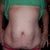 Muscles were seperated to the point where you see it stick out on both sides.