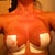 Day 1 - swollen and sore but wow :)