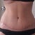 I see more defined abs!  I don't understand why I look so a-symetrical.  I guess I always was and never noticed because of all the skin!  lol...  Before the procedure I was so worried that my upper abs would just look like 1 muscle in the middle with the plication.  Not the case!  YAY!