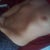 As you can see I have a big river cage but very small small small, did I say small breasts. I am hoping there will be some definition in my belly since there already is some when the skin is pulled down.