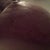 2 wks T incision   under right side thinning & some seperation