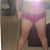 20 days post op, i do need to get someone to take pic of me instead of trying to do myself, lol