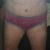 20 days post op, at least that huge apron is gone, im very happy so far