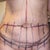 Pre surgery markings