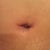 BB still has some stiches in.