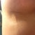 Mondors cord it hurts