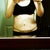 3 week post op.  My right side is more swollen as you can see.  Looks like I have love handles.