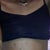 5 days post-op! Looking pretty good so far.
