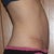 3 months, evening, more swollen