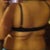 need full liposuction of the back