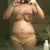Day 9 PO
I think my incision and my belly button are to close together.