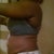before pic of the belly and booty- Night before the surgery..