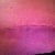 Close up of my scar Day 19.  If it looks this good less than 3 weeks old, I am sure Dr Wotowic is right and I will have an "invisible scar" by the end