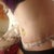 im hoping to get some proper pics tomorrow during shower...PO day 1
