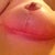 4 weeks post op!!! Right breast. Looking fantastic! I am loving the Bio Oil!