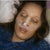 Day 1- Right after surgery(Still feeling the anesthesia)