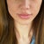 1/2012, 3 1/2 weeks post botox in jaw