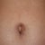 My belly button at 8 weeks