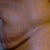 before (yuk) side pic