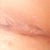 Week 4 side bit still to heal properly.  PS said will be same as front