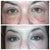 Day 14 - still a little bit of bruising and swelling but not too bad. Top picture is, of course, without makeup. Bottom picture is with a ton of makeup. Not too bad!