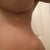 9 Weeks PO Up close contouring by PS