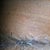 this is how my incision is looking. Its dry because I have to pass alcohol on it every day. It also have the tape on it.