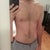 Post Op - 9 weeks