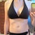 Hmmm, swimsuit one/ 5 weeks post op